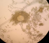 4608-aspergillus 400x 2